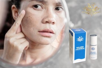 melasma colostrum