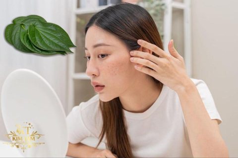 Cách chữa nám da mặt bằng lá trầu không