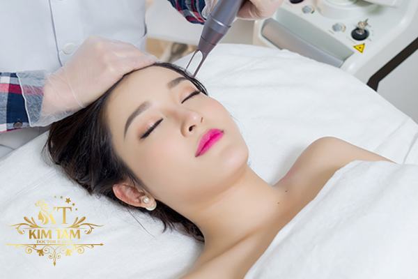 trị nám bằng laser